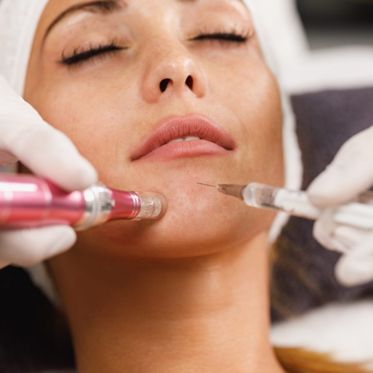 Shot of a beautiful young woman on a facial dermapen micro-needling treatment at the beauty salon.