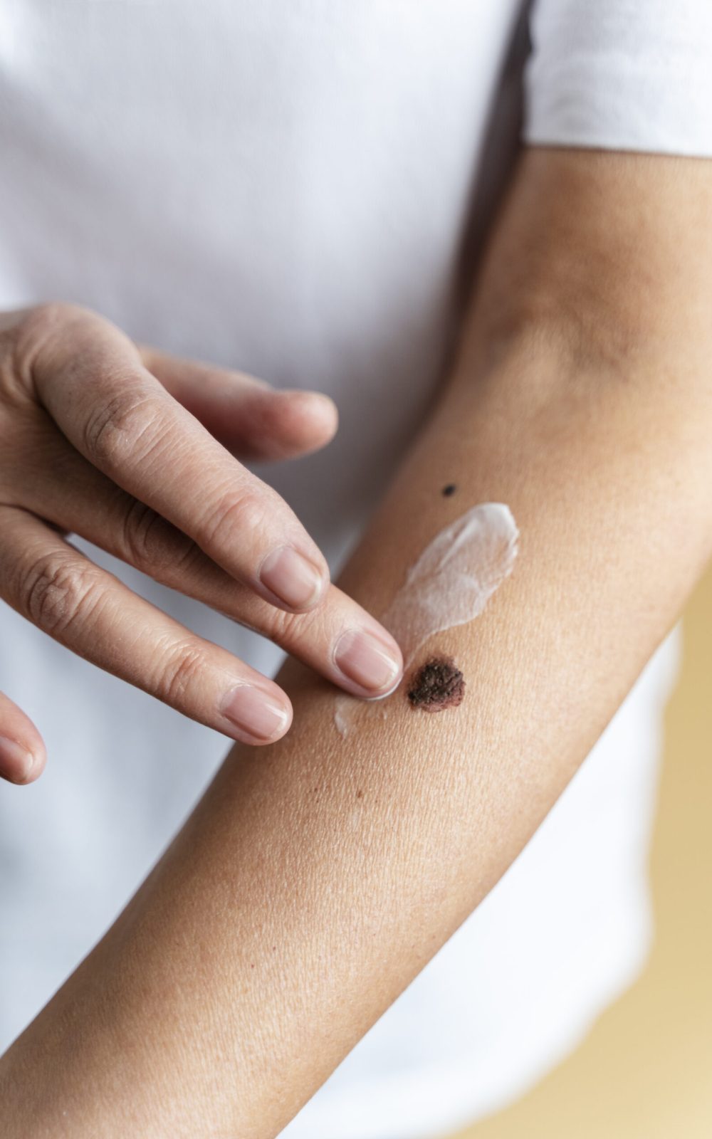 mano-de-angulo-alto-aplicando-crema-en-el-brazo