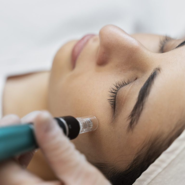 persona-que-recibe-un-tratamiento-de-belleza-con-microagujas