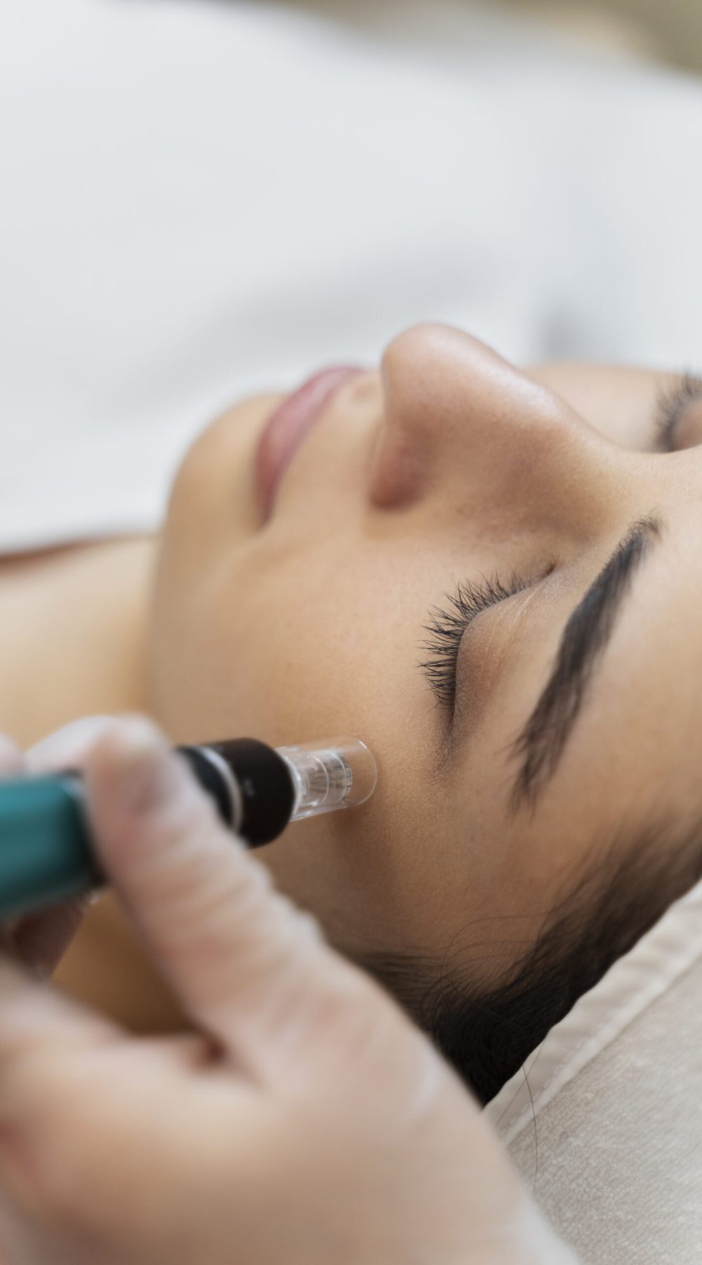 persona-que-recibe-un-tratamiento-de-belleza-con-microagujas